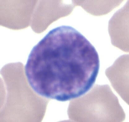 This is a Lymphocyte. A lymphocyte is a kind of white blood cell in the vertebrate immune system